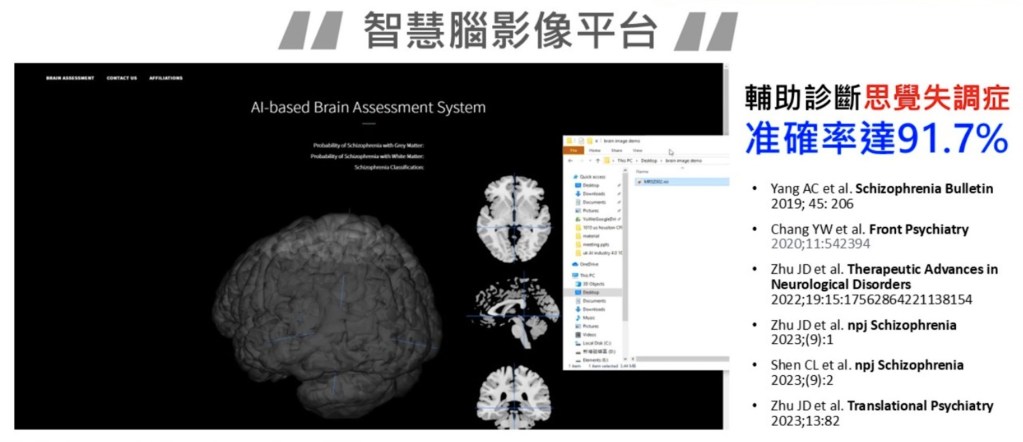 卡陰撞邪不用怕！北榮發表全球首創智慧腦影像平台幫助思覺失調患者 